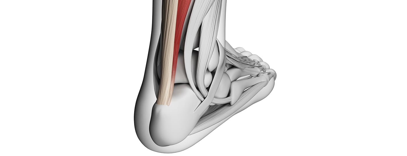 achilles_head