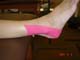 kinesio-2